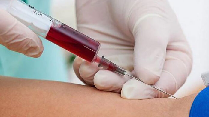 sarepol-for-the-first-time-laboratory-blood-was-injected-into-patients