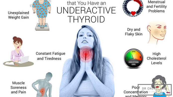 sarepol-what-are-the-symptoms-of-hypothyroidism