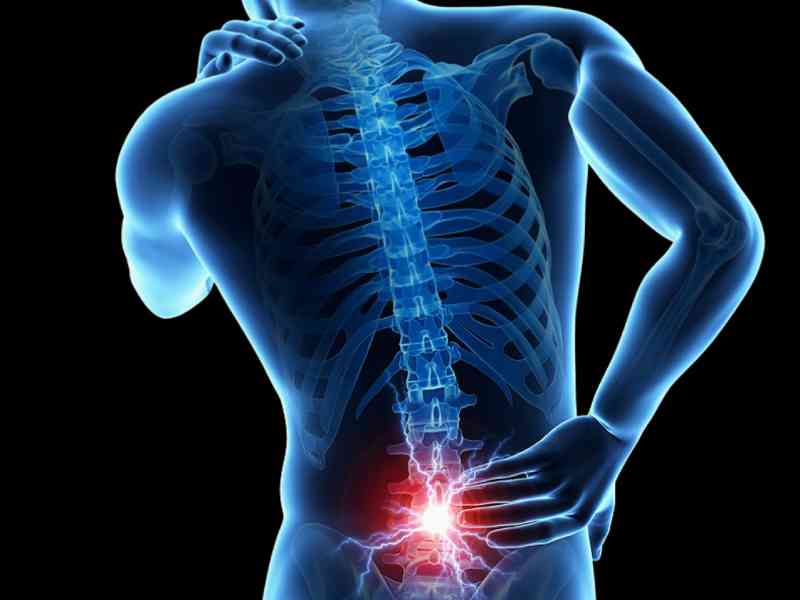 familiarity-with-some-spine-diseases-and-their-treatment-methods